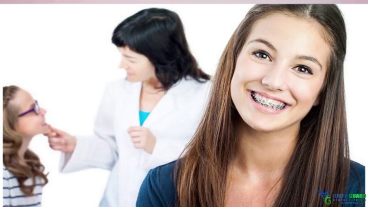 Dental cantilever bridge